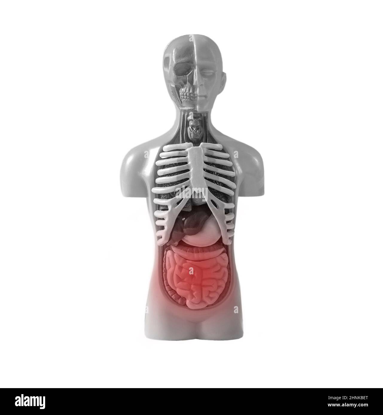 Intestinal inflammation. Intestine in human body model isolated on white background. Human digestive system study. Medical education concept. High quality photo Stock Photo