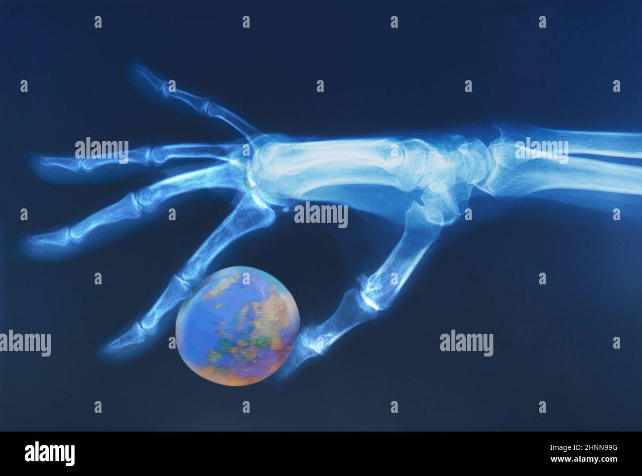 X-ray medical scan of human hand holding world globe. Europe and Middle East showing. War, global warming, oil. World crisis. Planet climate change Stock Photo