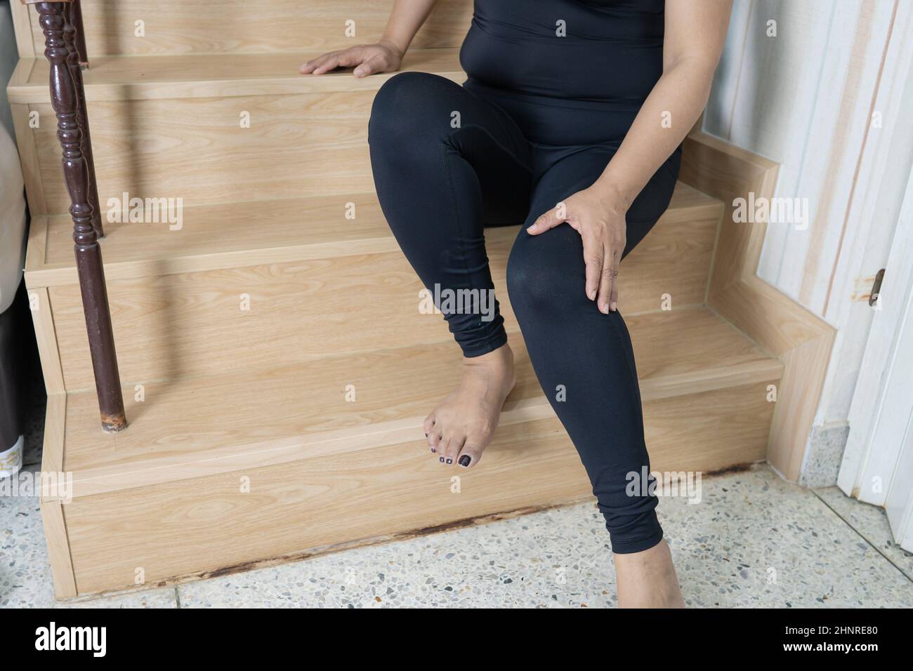 Asian middleaged lady woman patient fall down the stairs because