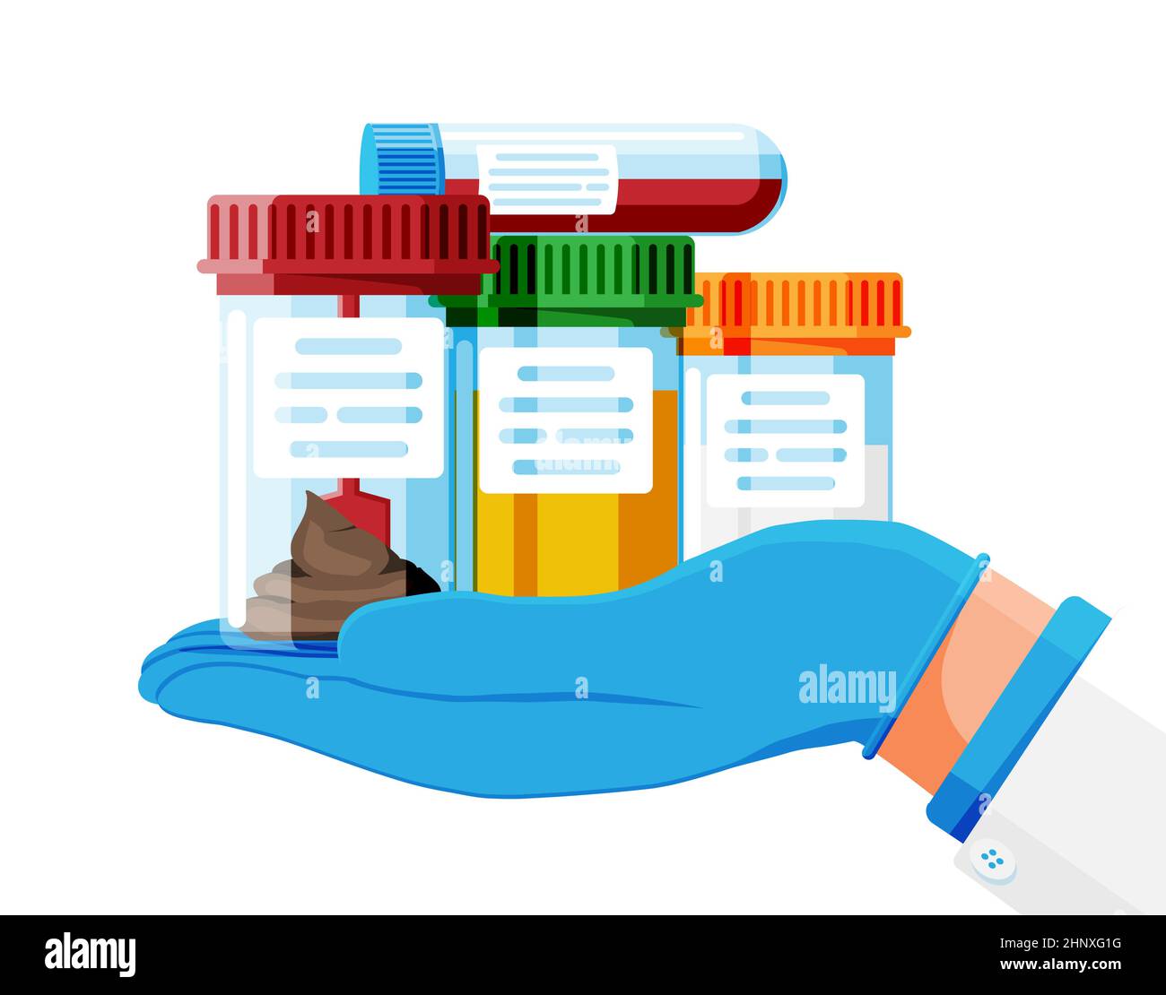 Test Tubes with Caps. Stool, Blood, Urine, Sperm Stock Vector Image
