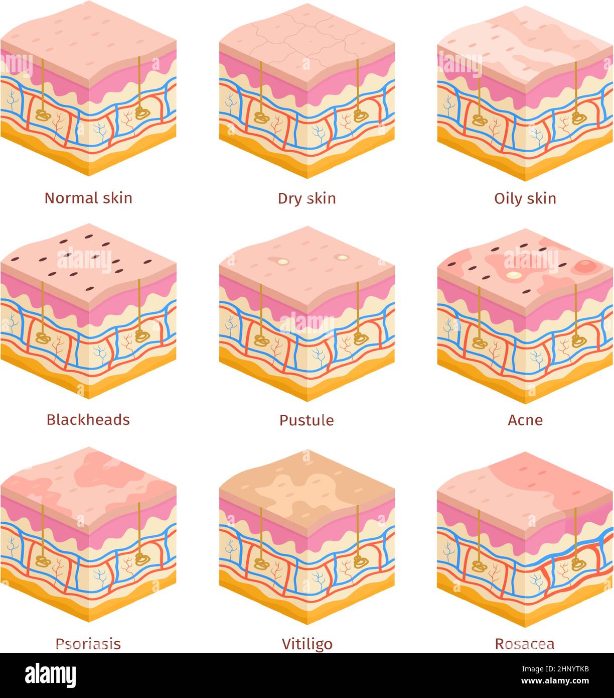 3d human skin types cross section layers. Dry, oily and normal