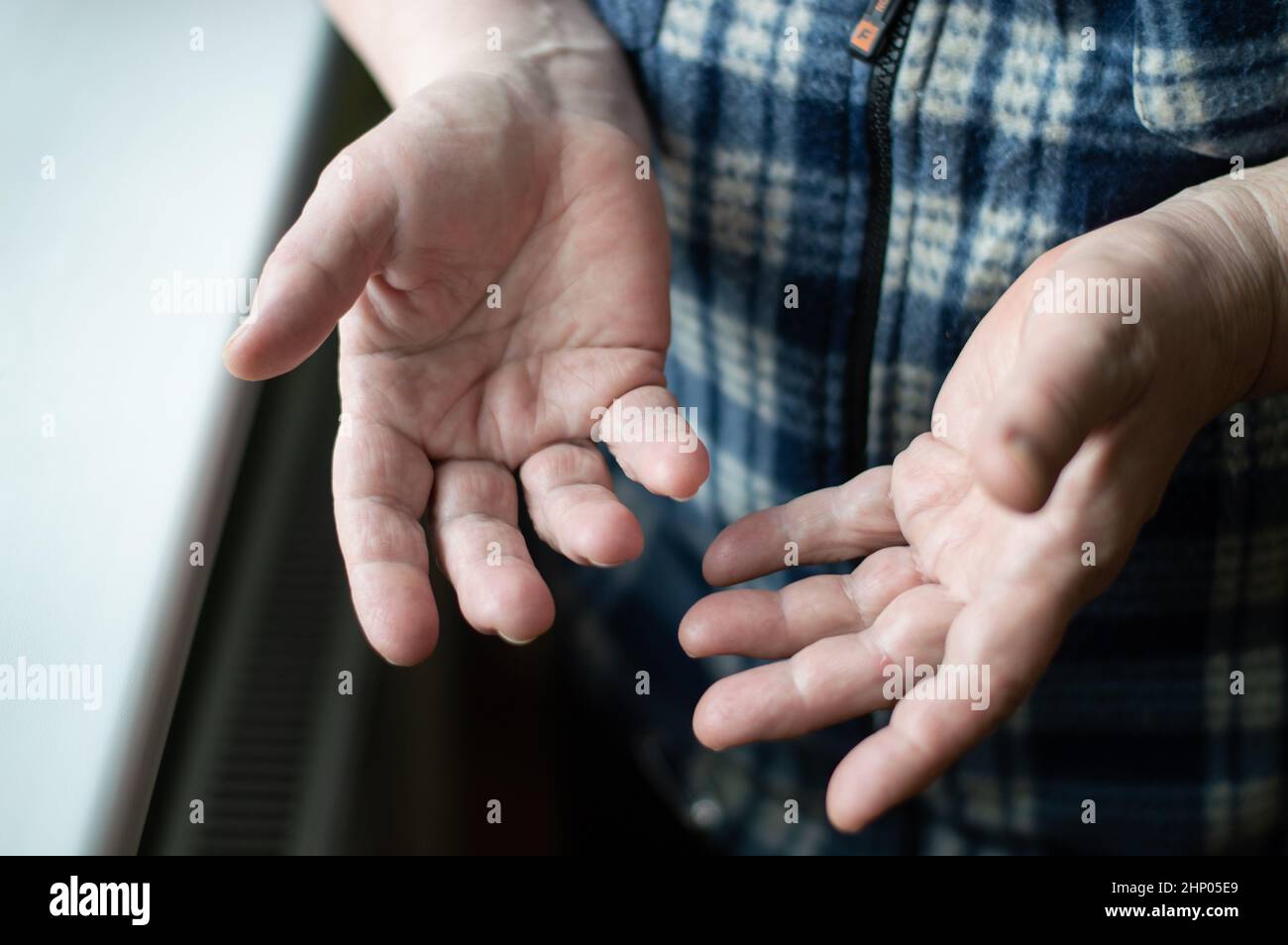 Hands Close Up Hands Of A Middle Aged Woman Senior Wrinkled Skin