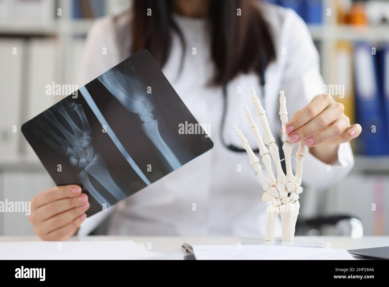 X-ray of the hand in the hands of a doctor, blurry Stock Photo
