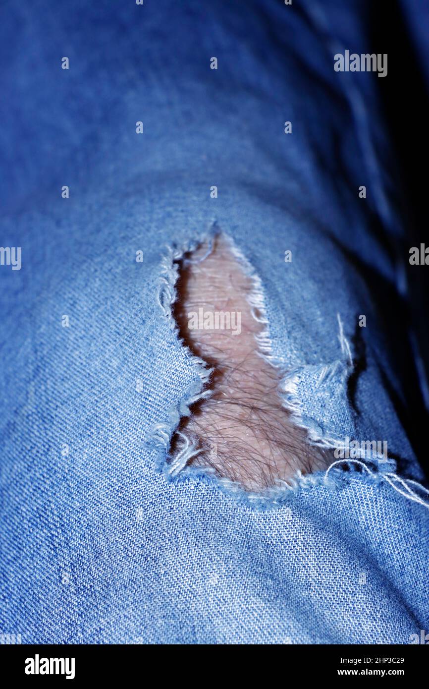 Loch in einer bluejeans, darunter ein behaartes Männerbein Stock Photo