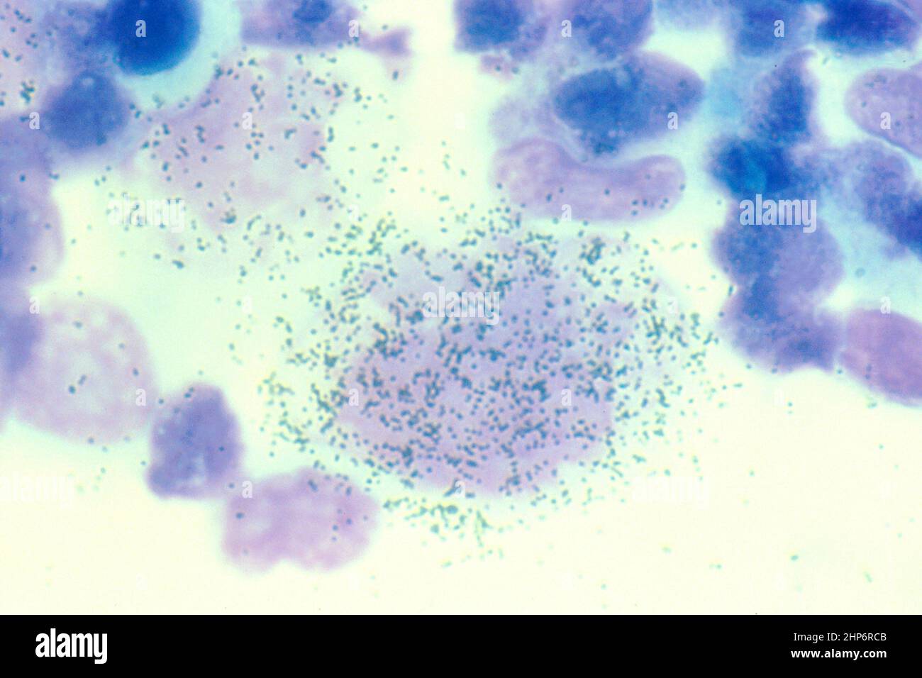 HHV-6: Radioactive IsotopeDescription This is a histological slide ...