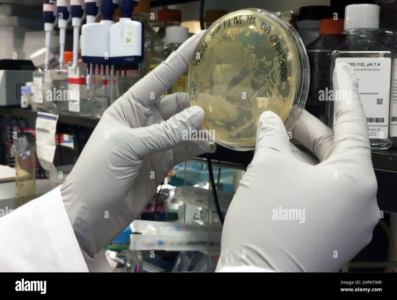 NIAID (NIH) scientist researching COVID-19 vaccine examines agar plate ca.  30 January 2020 Stock Photo