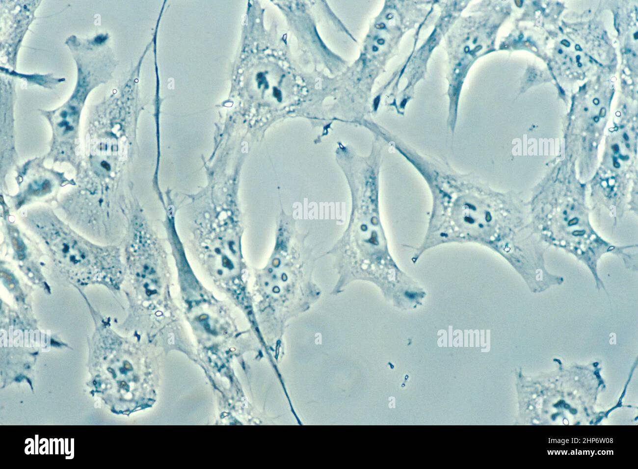 Normal cells from human connective tissue in culture at a magnification of 500x, using a darkfield amplified contrast technique ca.  November 1987 Stock Photo