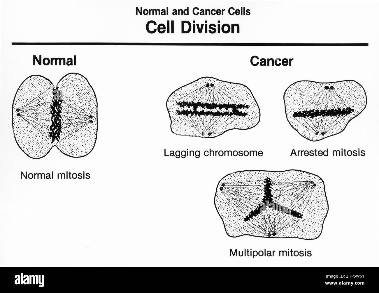 Normal cells and cancer cells undergoing cell division, showing the ...