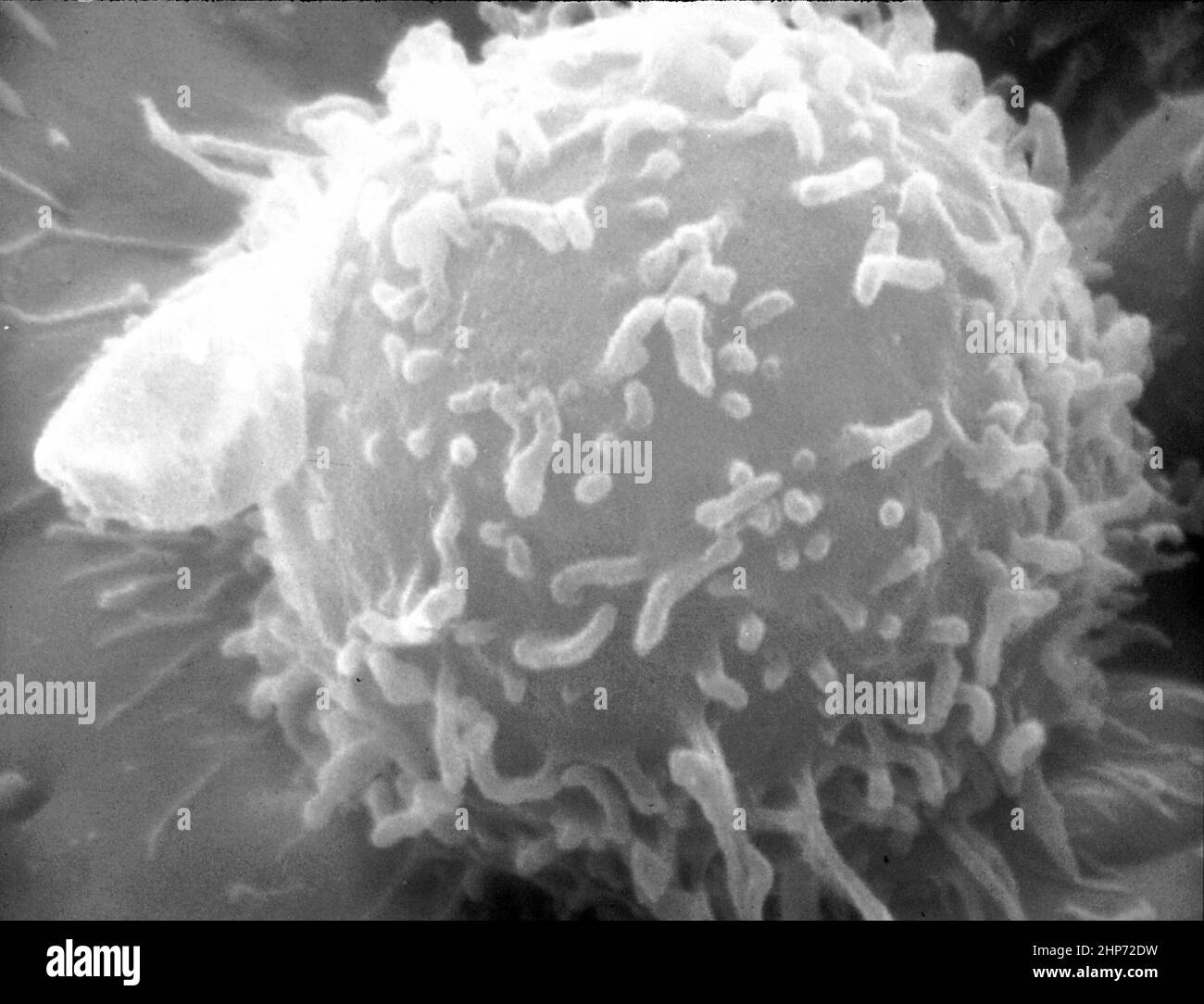 Electron microscopic image of a single human lymphocyte ca.  September 1976 Stock Photo