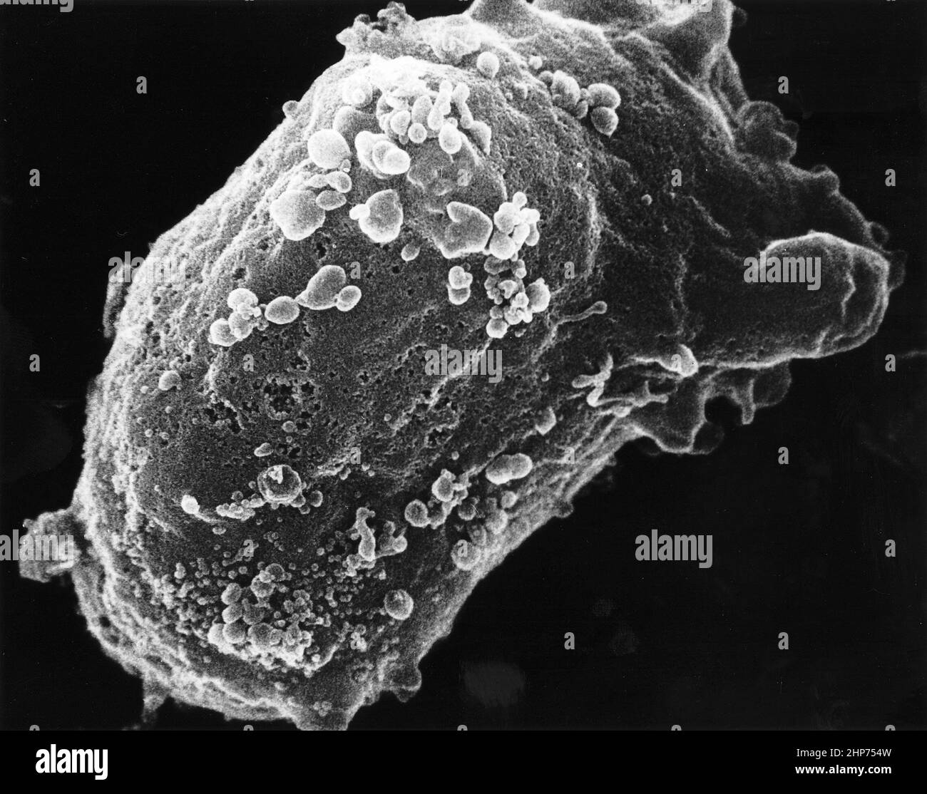 Lymphocyte With HIV ClusterDescription Scanning electron microscope (SEM) image of a lymphocyte with HIV cluster ca.  Unknown date Stock Photo