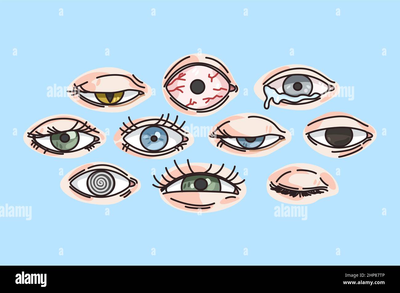 Collection of various eye disease or problems Stock Vector