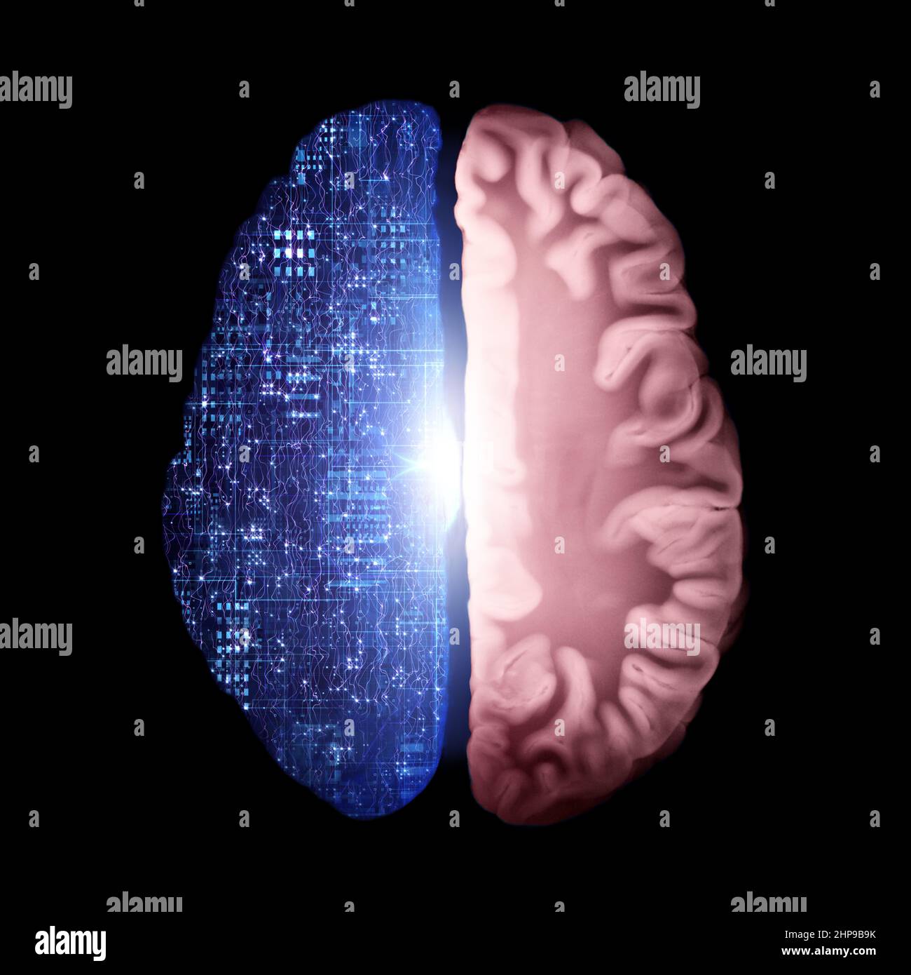 Brain Cross Section Connected To Central Processing Unit, Cyber Neural Networks, Neurolink, Artificial Intelligence, Cpu, Big Data, Internet Networks Stock Photo