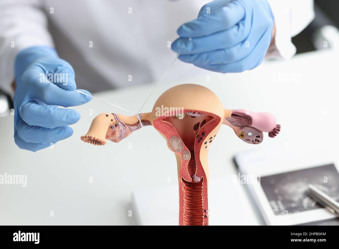 Fallopian tube hi-res stock photography and images - Alamy