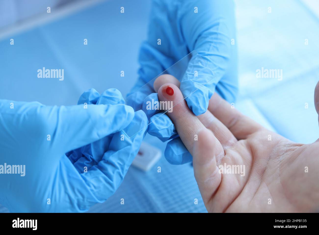 Doctor takes blood sample of patient serological test for PRP blood antibodies Stock Photo