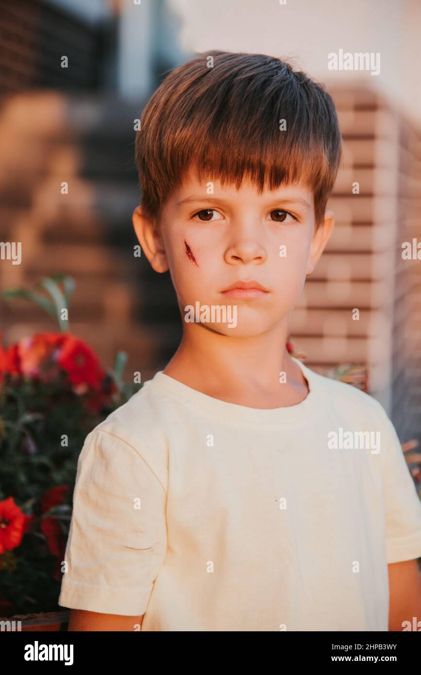 Portrait of a cute boy with a scar on his face Stock Photo - Alamy