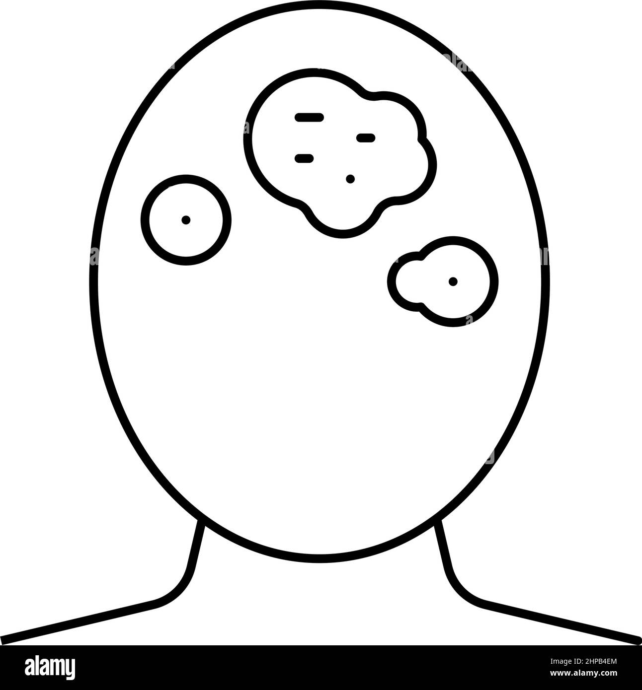seborrhoeic dermatitis skin disease line icon vector illustration Stock ...