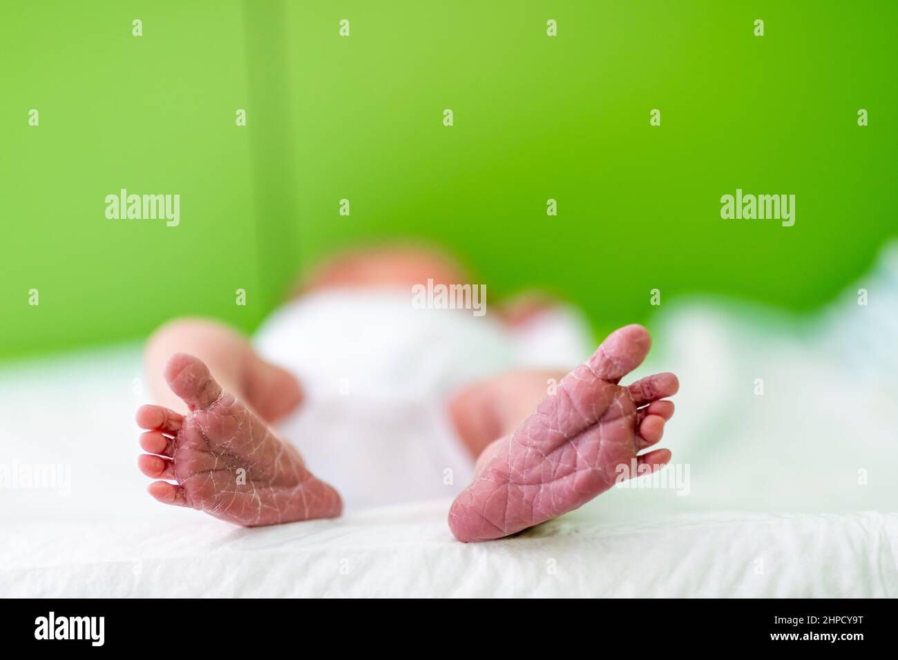 cracked and dry feet of a newborn baby in the hospital. concept health