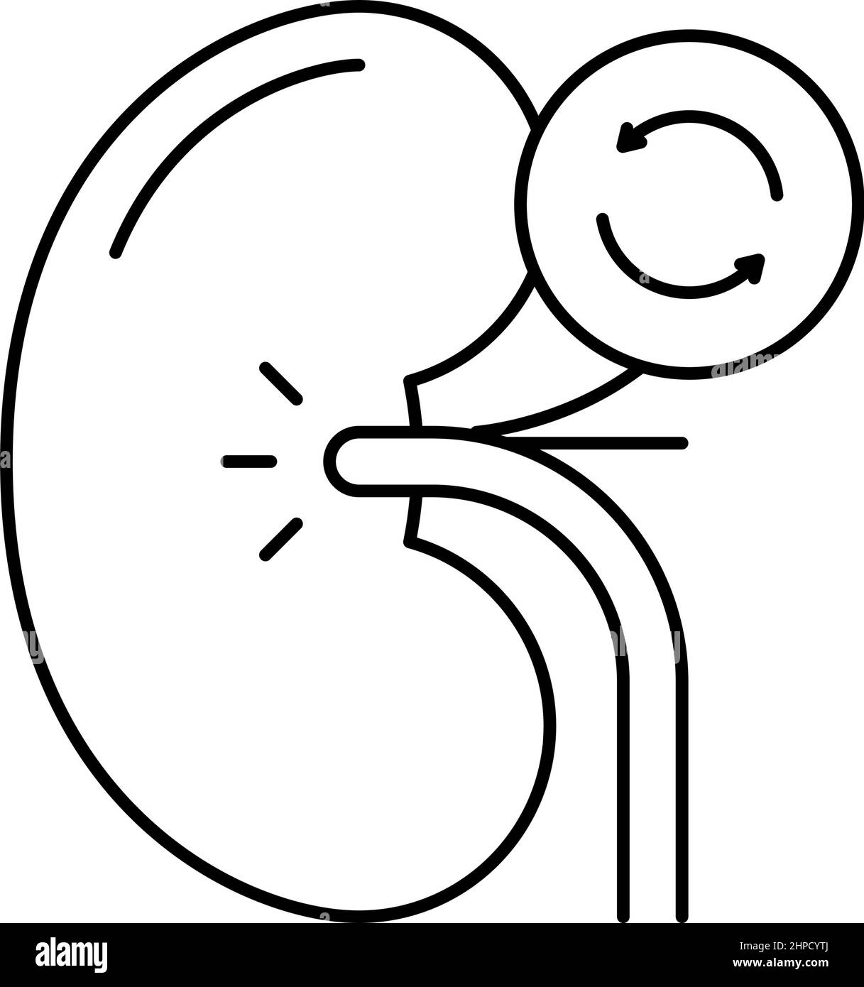 Kidney transplant Black and White Stock Photos & Images - Alamy