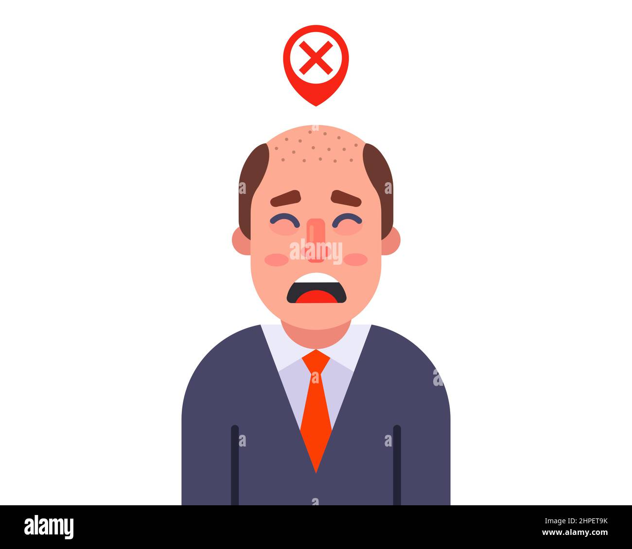 upset man with bald head. worry about hair loss. flat vector illustration. Stock Vector