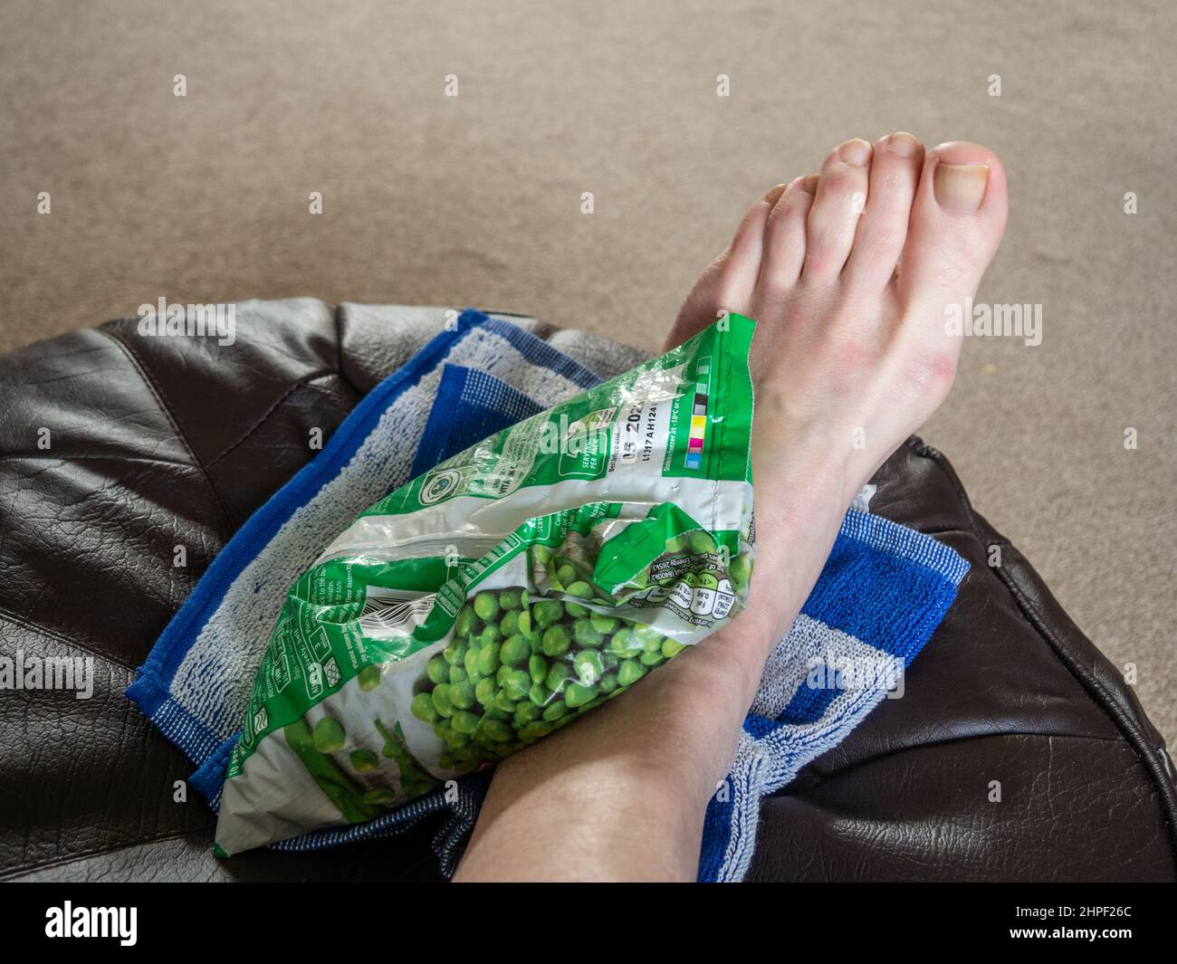 Man treating an ankle injury with a bag of frozen peas - part of the rest, ice, compression, elevation (or RICE) procedure, UK Stock Photo