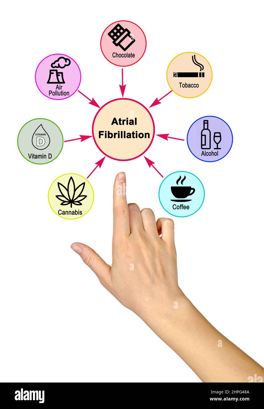 Seven Causes of Atrial Fibrillation Stock Photo Alamy