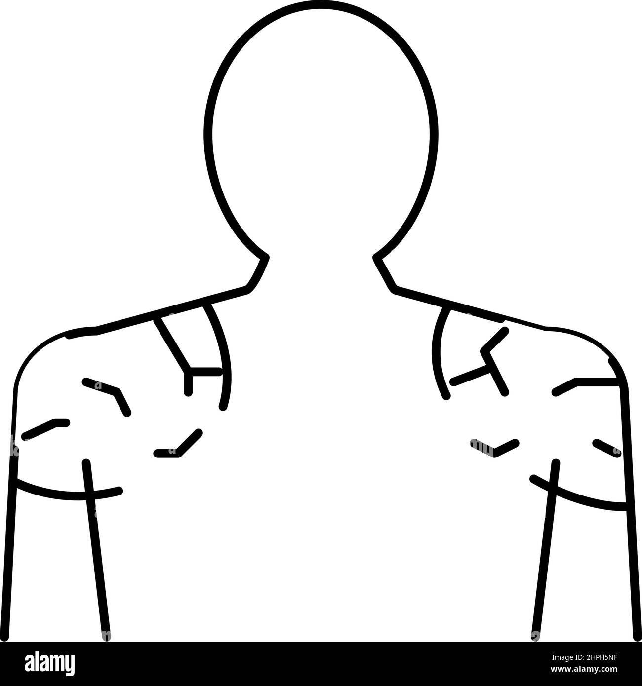 shoulders dry skin line icon vector illustration Stock Vector Image ...