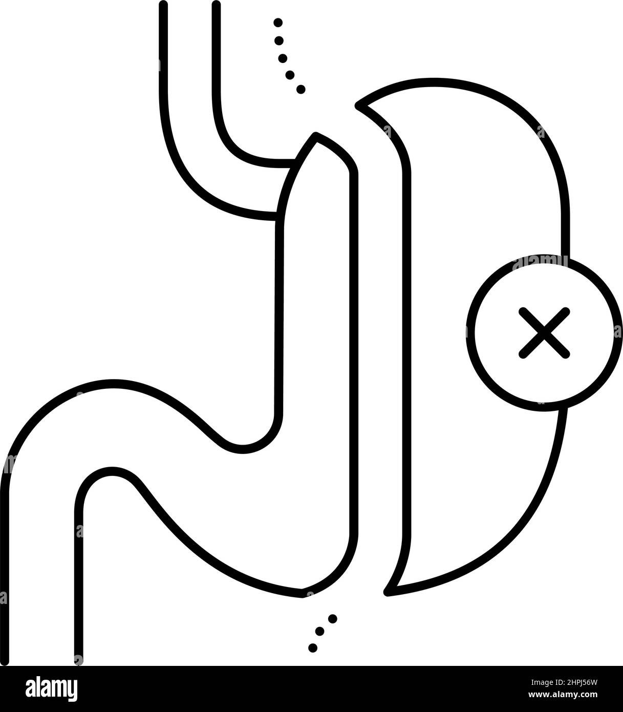 sleeve resection bariatric line icon vector illustration Stock Vector ...