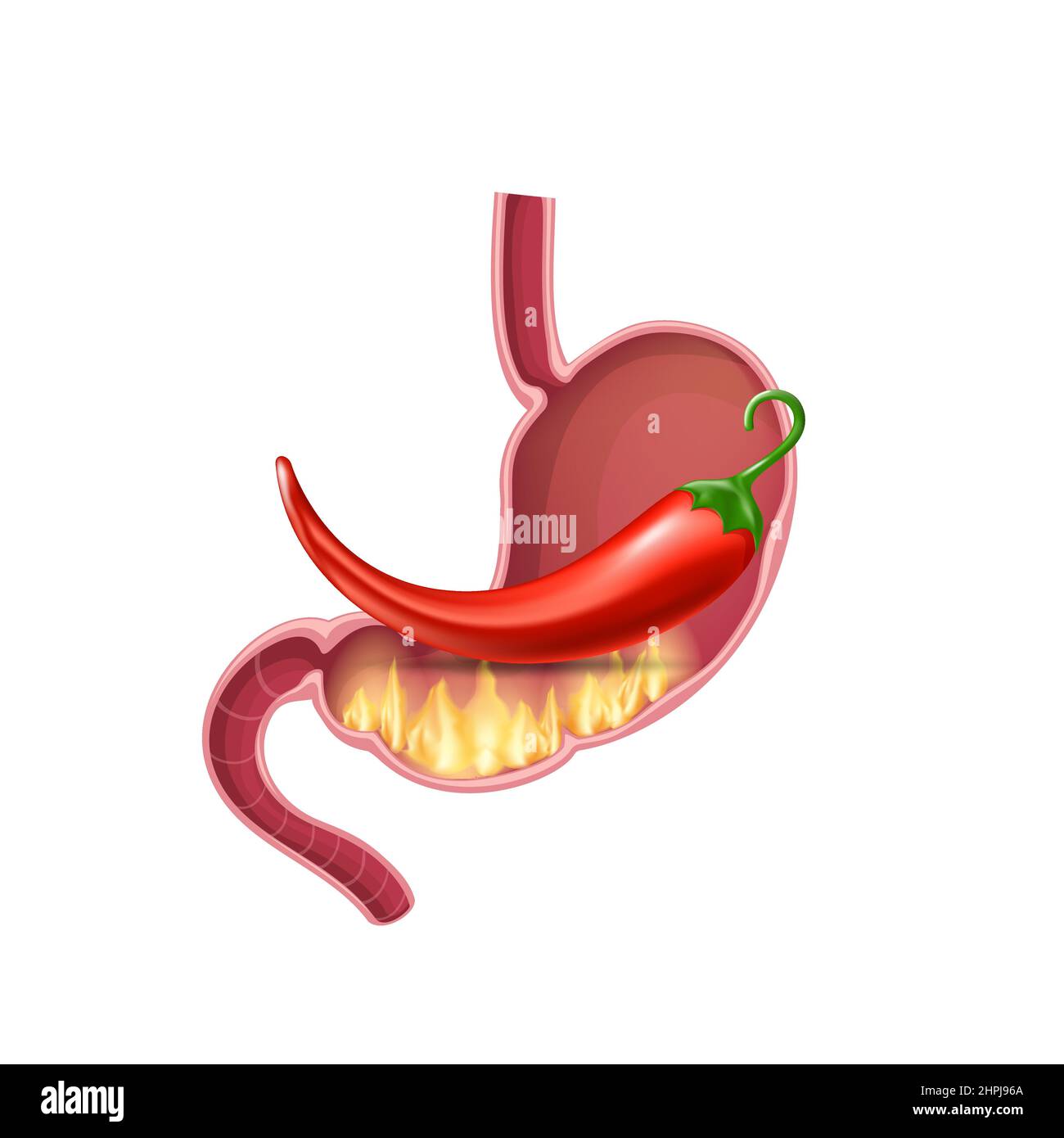 Stomach with red pepper fire, gas and gastric acid. Healthy food
