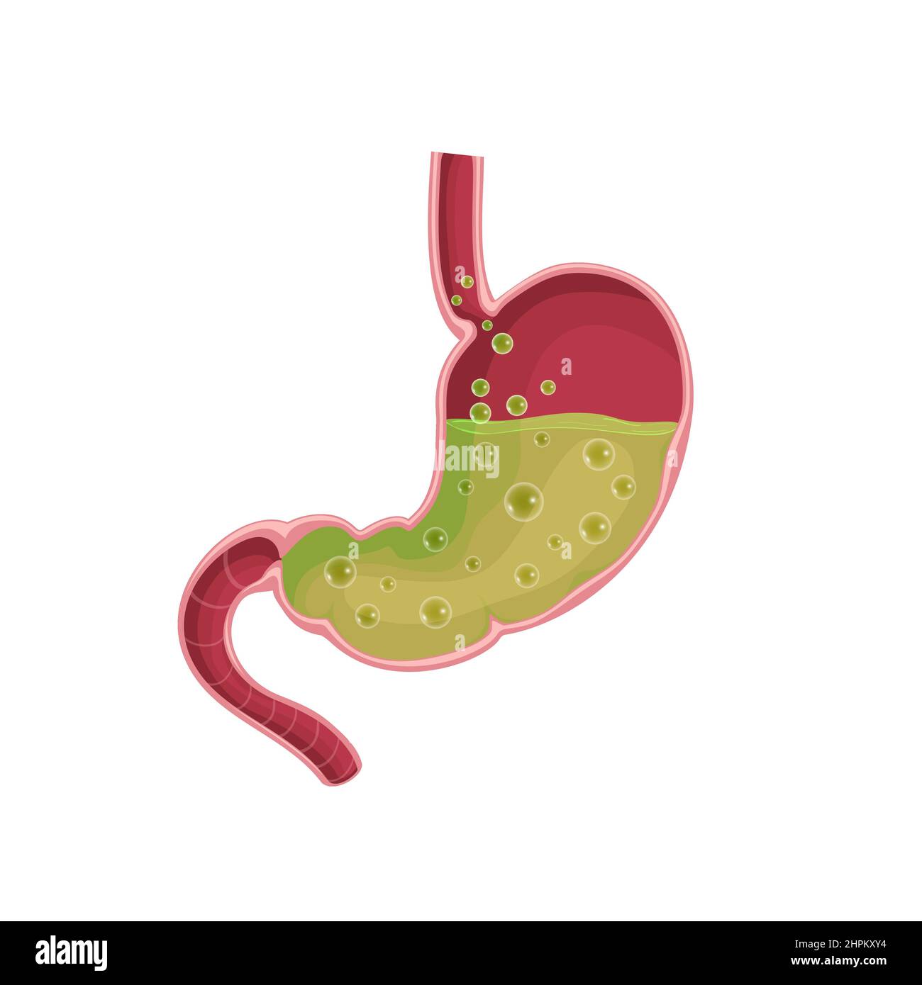 Stomach. Nausea. Diseases of the stomach. Vomiting Flat illustration