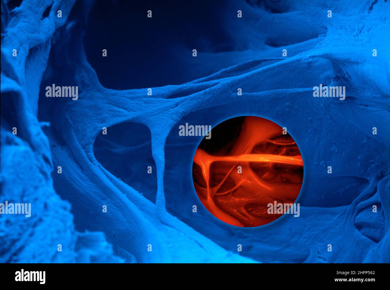 Interior of human heart, SEM and endoscopy Stock Photo Alamy