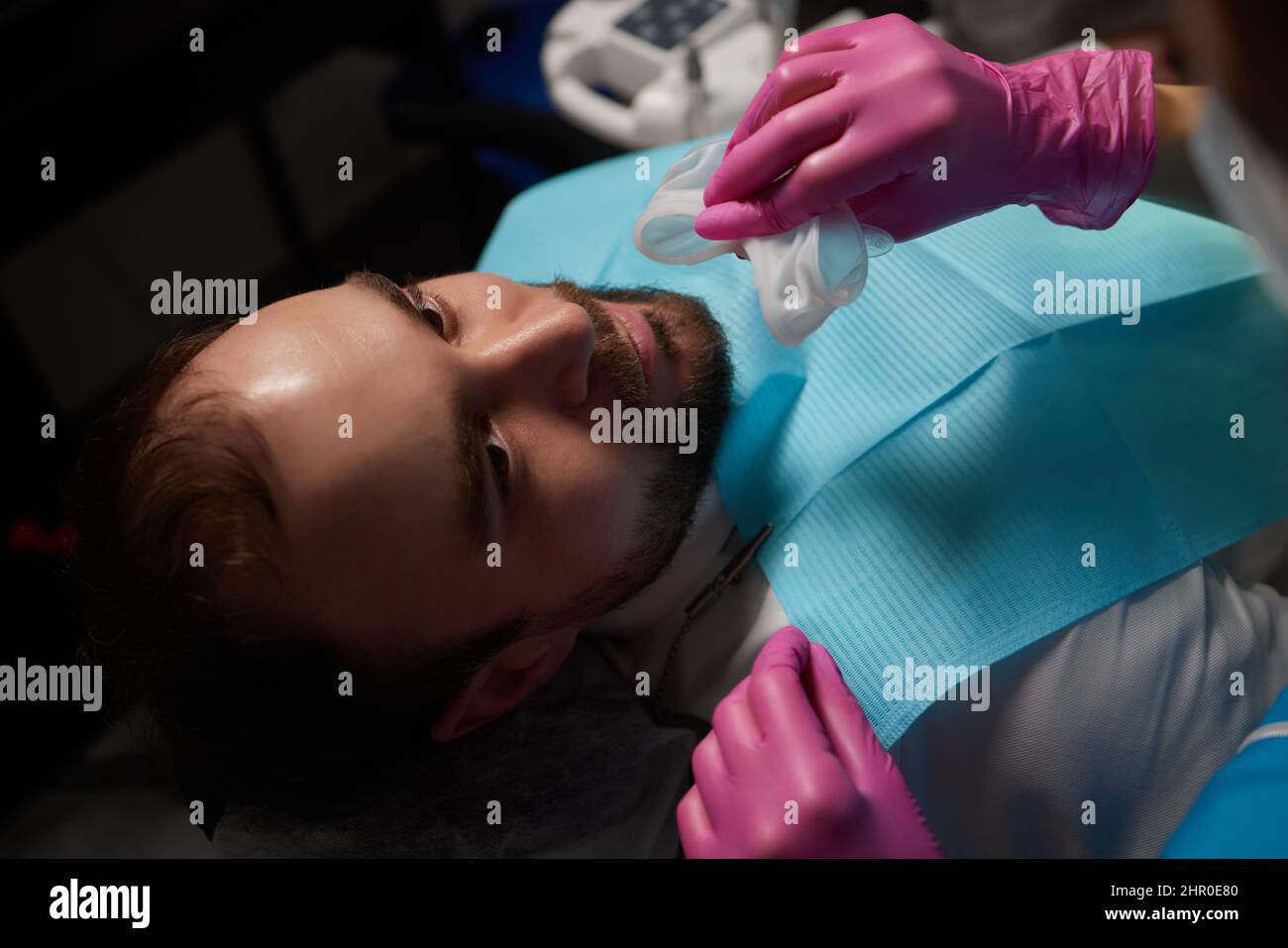 Closeup of man's teeth with retractor for mouth. Patient at the dentist ...