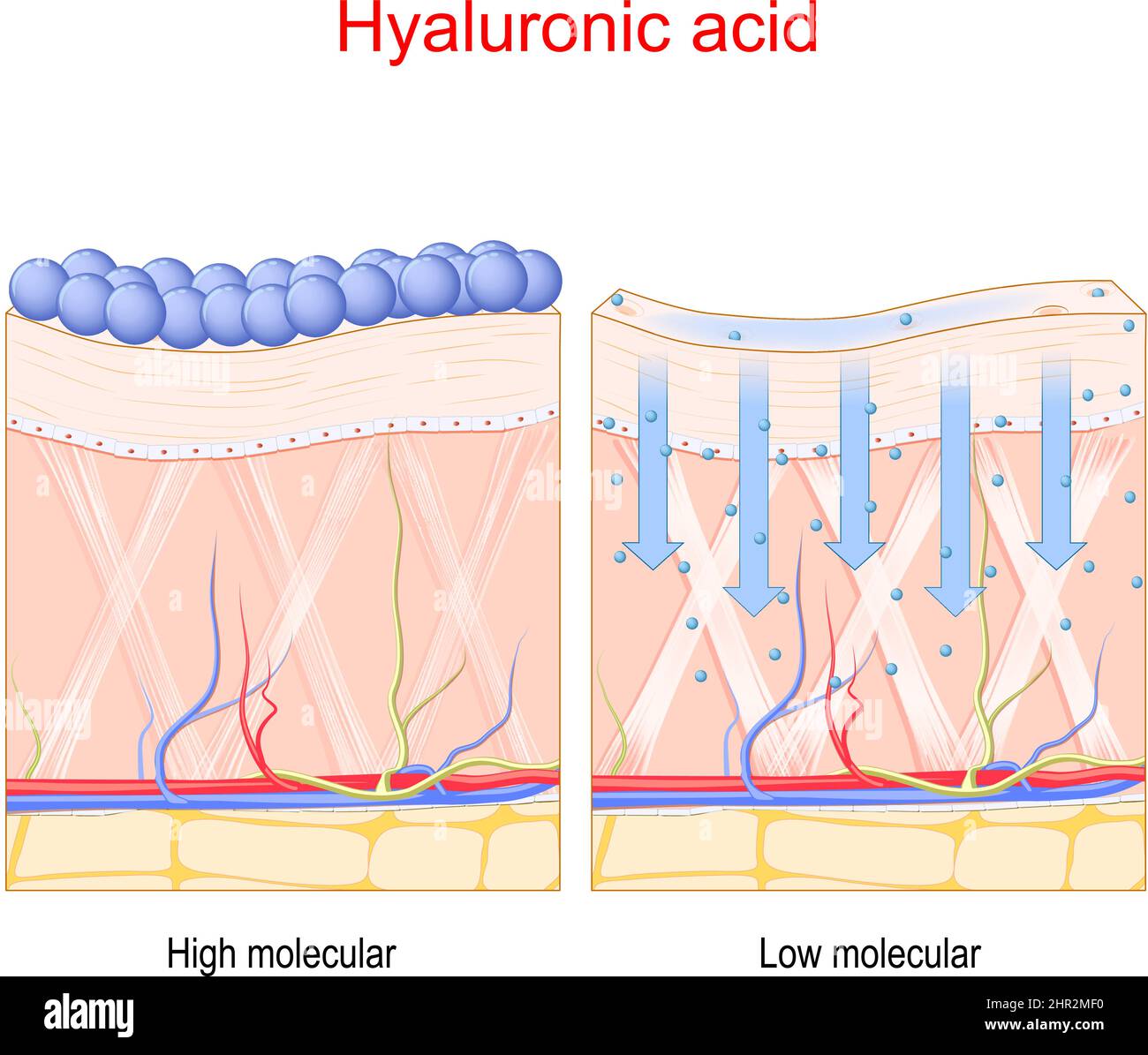 Hyaluronic acid. Penetration in the skin of Low and High molecule Hyaluronic acid. vector poster about skin care and anti-aging therapy Stock Vector