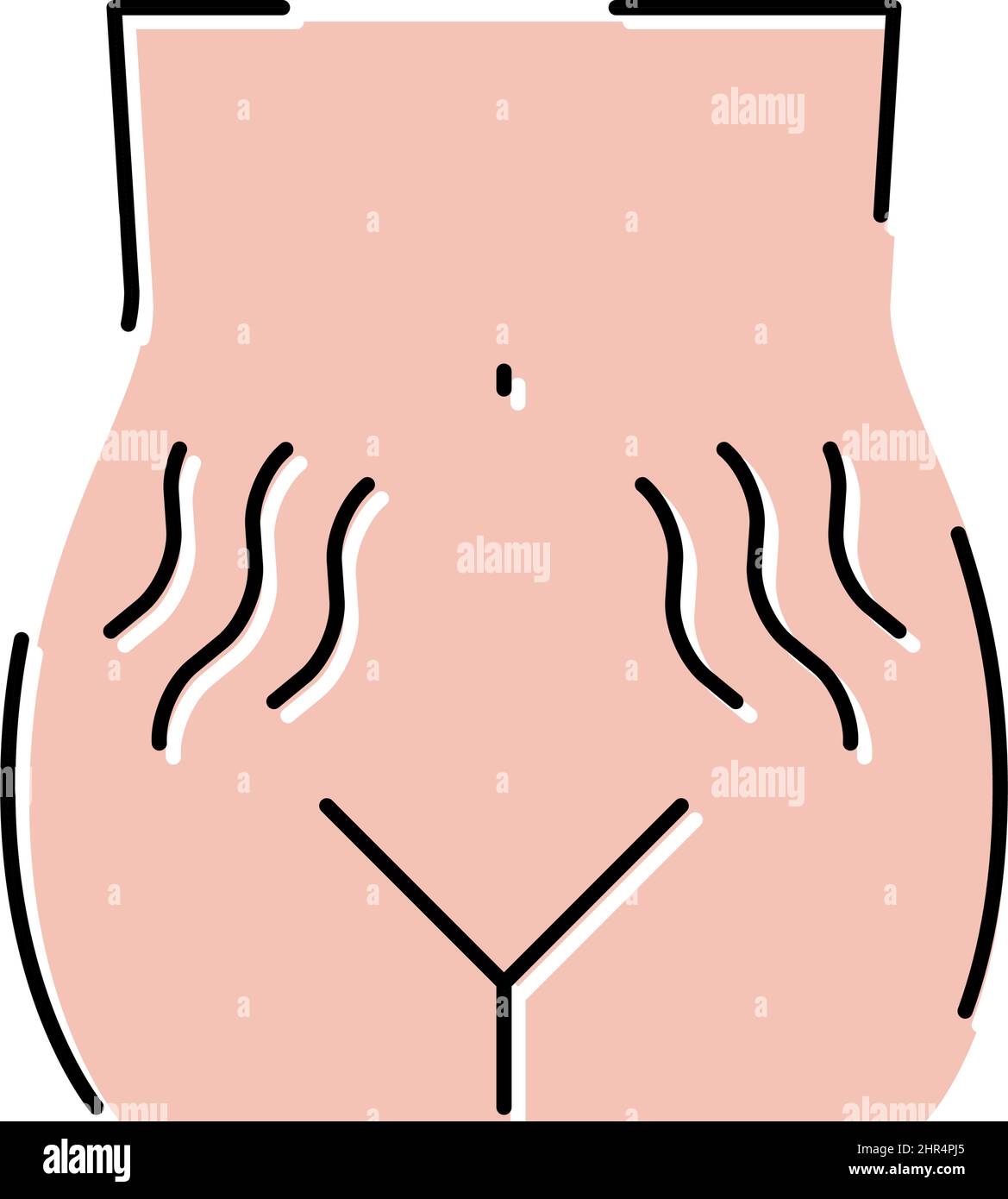stretch marks on skin disease color icon vector illustration Stock ...