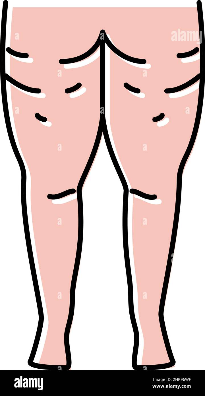 cellulite problem color icon vector illustration Stock Vector Image ...
