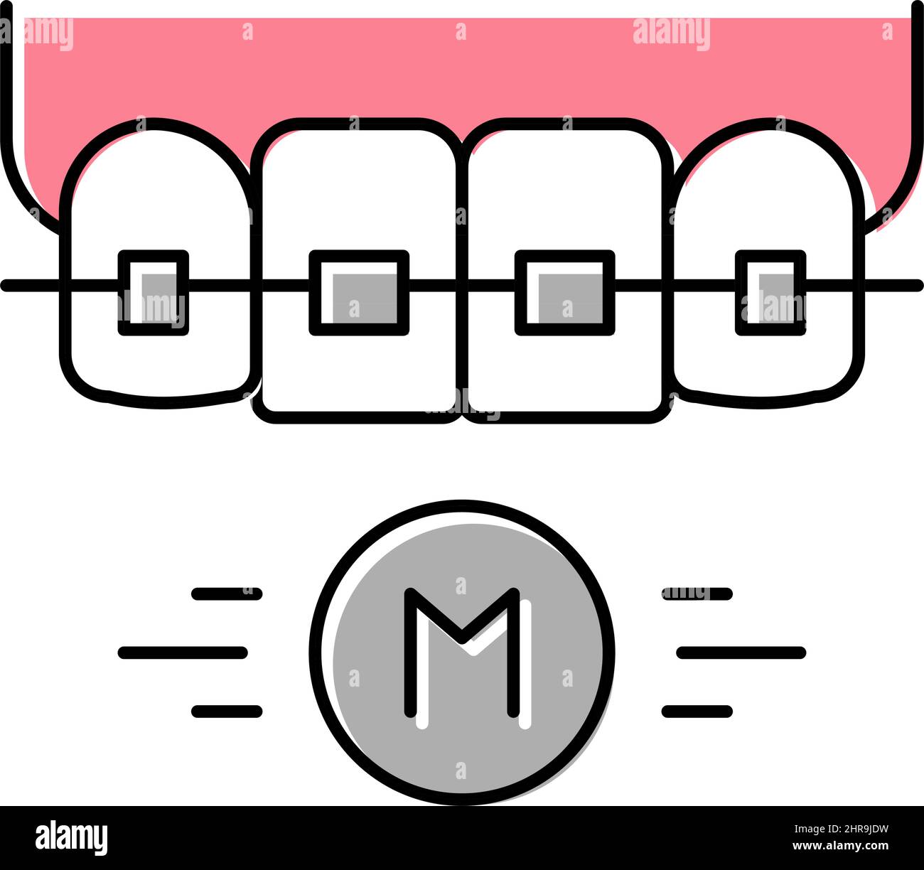 metal material tooth braces color icon vector illustration Stock Vector ...
