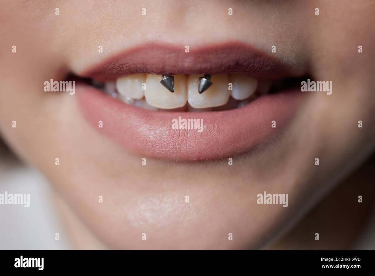 Lip frenulum piercing deals