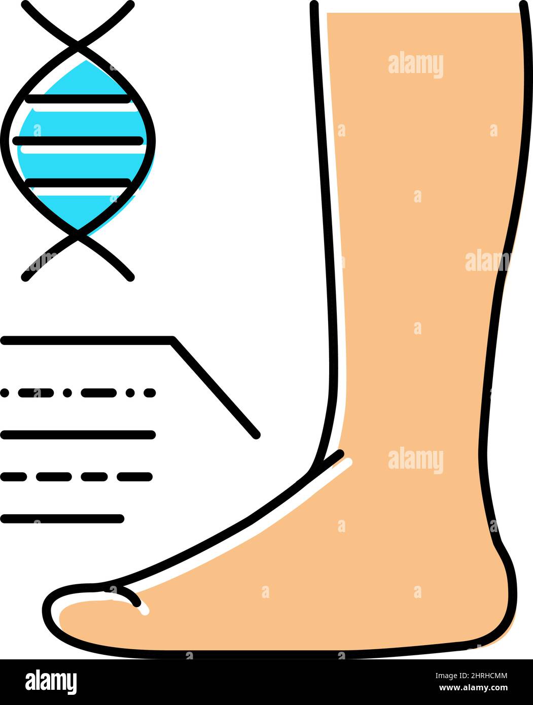 genetic flat feet disease color icon vector illustration Stock Vector ...
