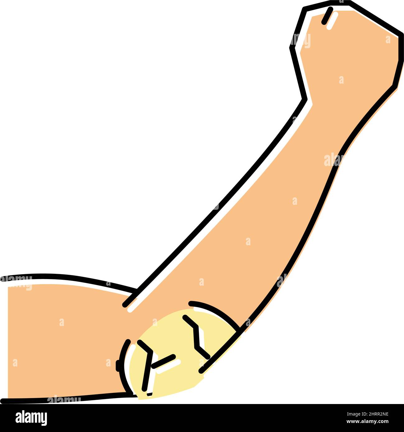 elbow dry skin color icon vector illustration Stock Vector Image & Art ...