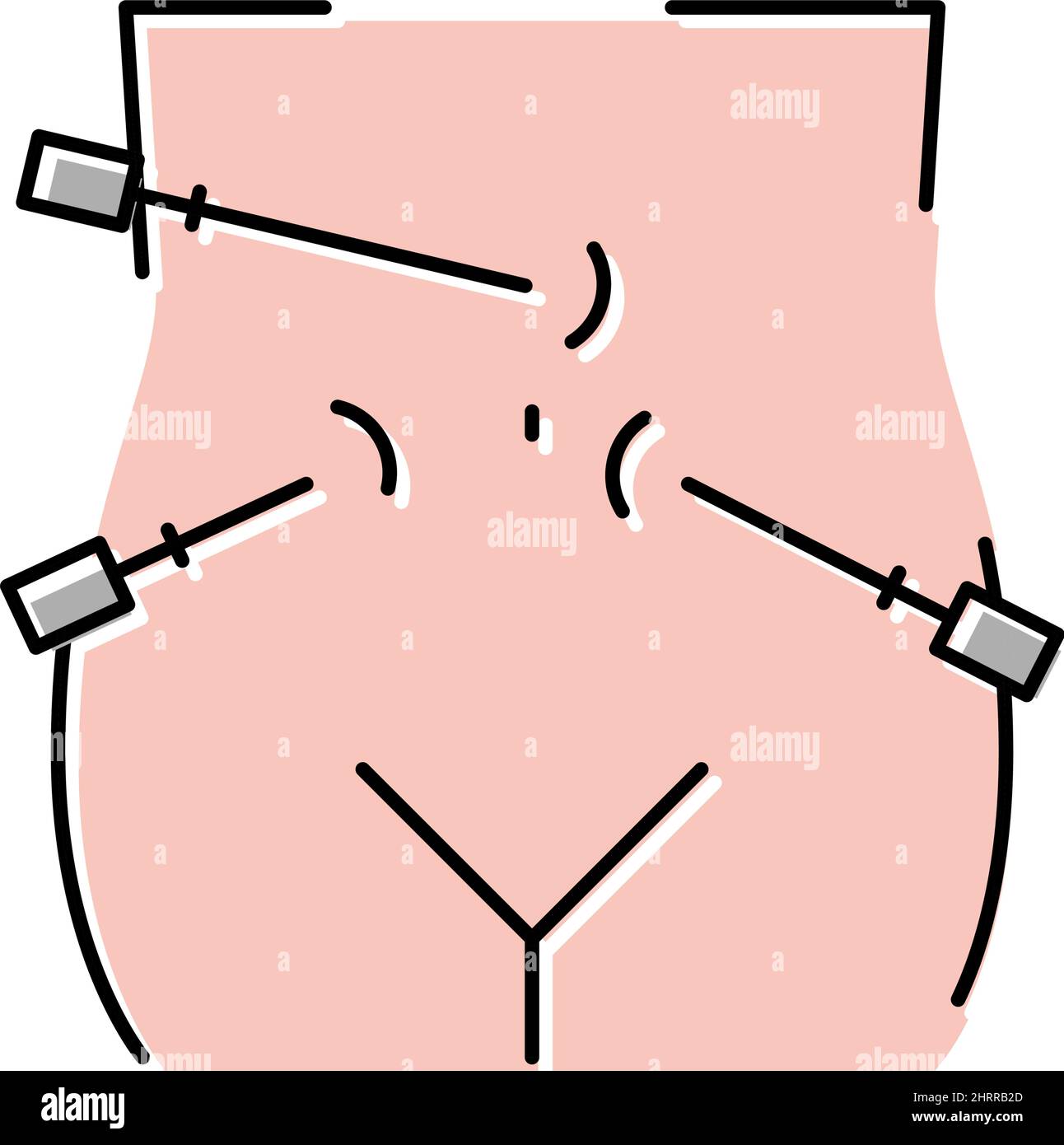 laparoscopy bariatric color icon vector illustration Stock Vector