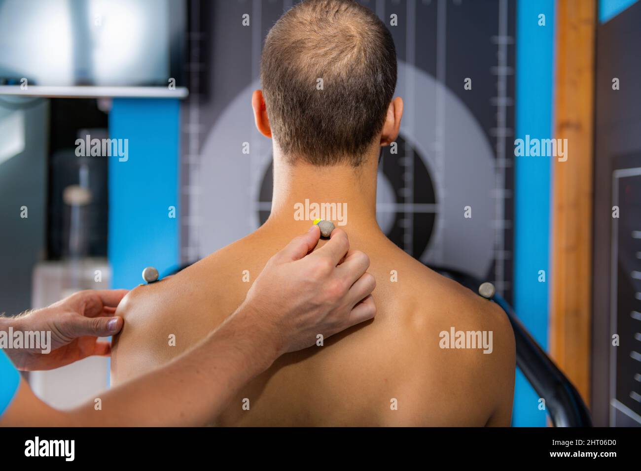 Placing markers on man's back for 3D gait analysis Stock Photo