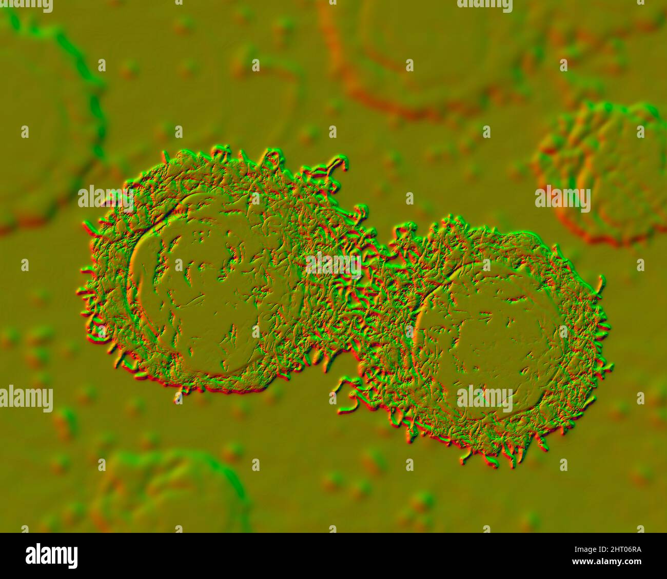 Abnormal cells hi-res stock photography and images - Alamy