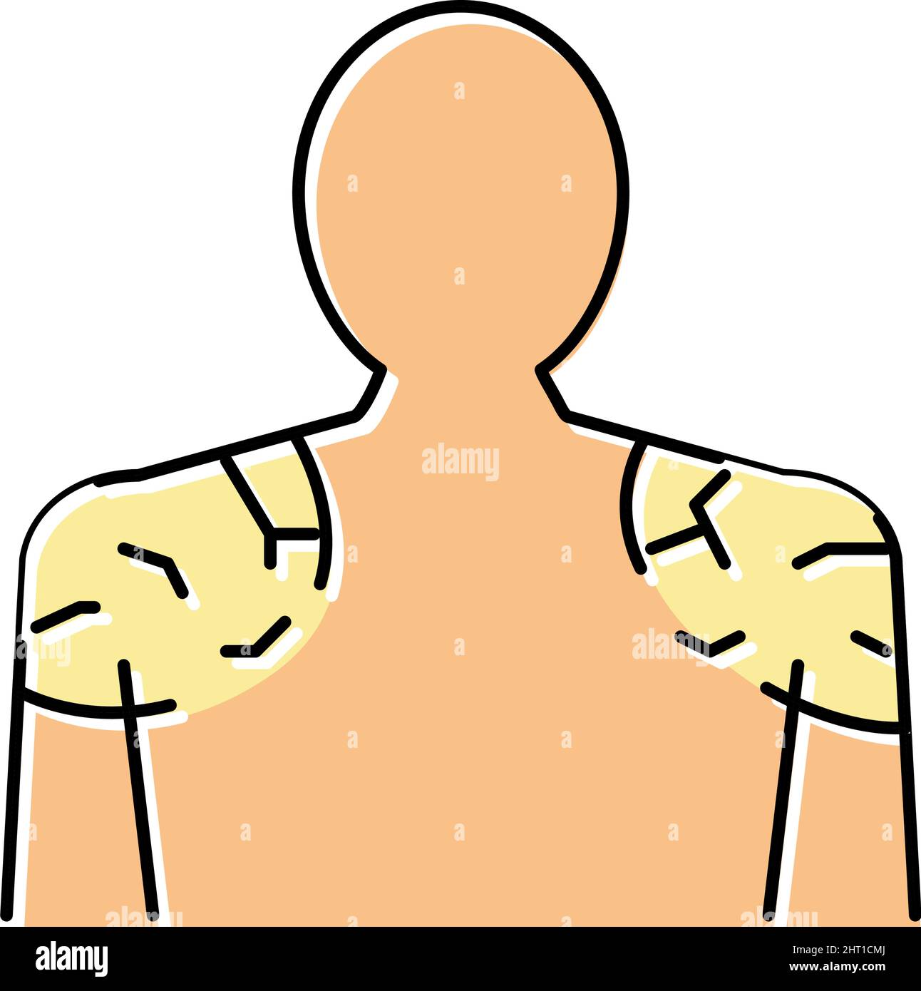 shoulders dry skin color icon vector illustration Stock Vector Image ...