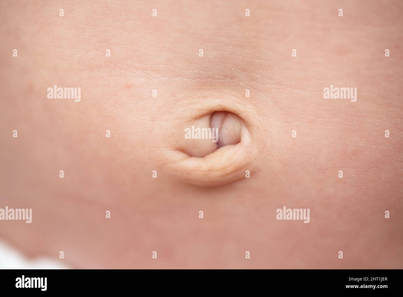 Close-up shot of a belly button of a small baby Stock Photo - Alamy
