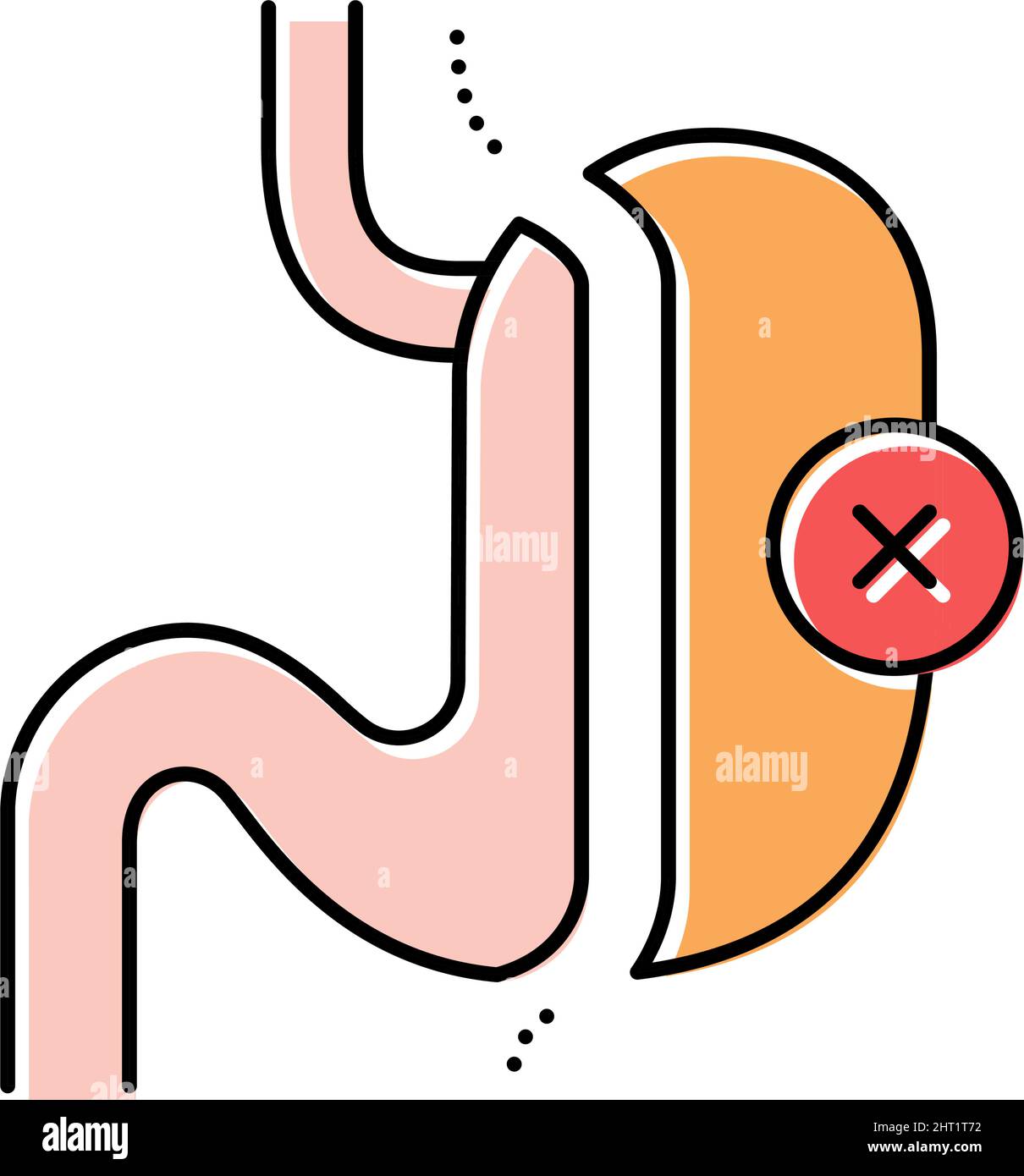 sleeve resection bariatric color icon vector illustration Stock Vector ...
