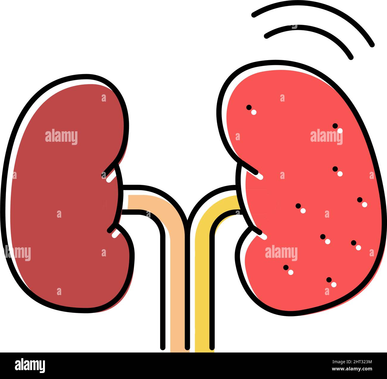 cancer kidney color icon vector illustration Stock Vector Image & Art ...