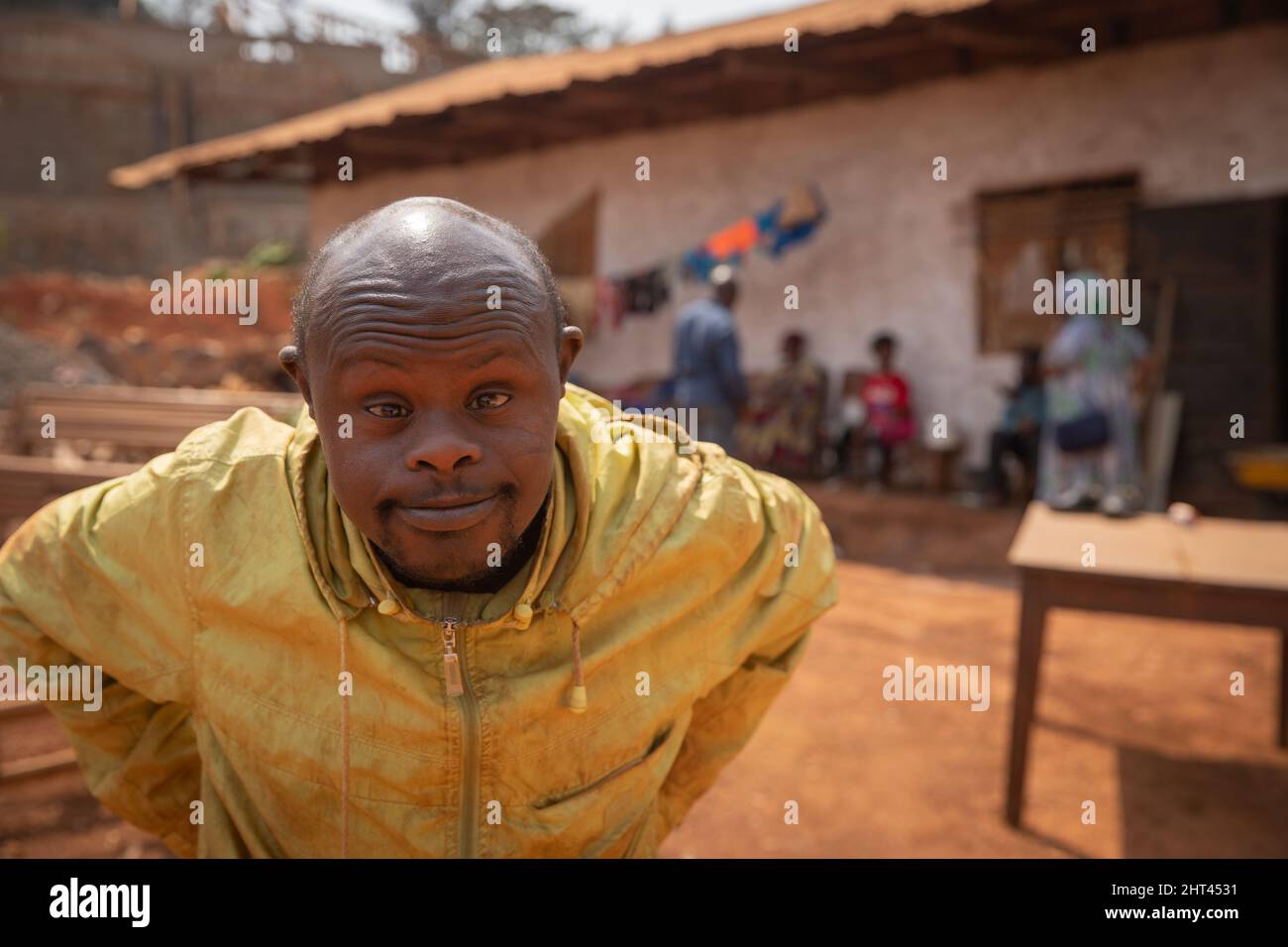 Portrait of an african man with Down syndrome is in an African village. Stock Photo