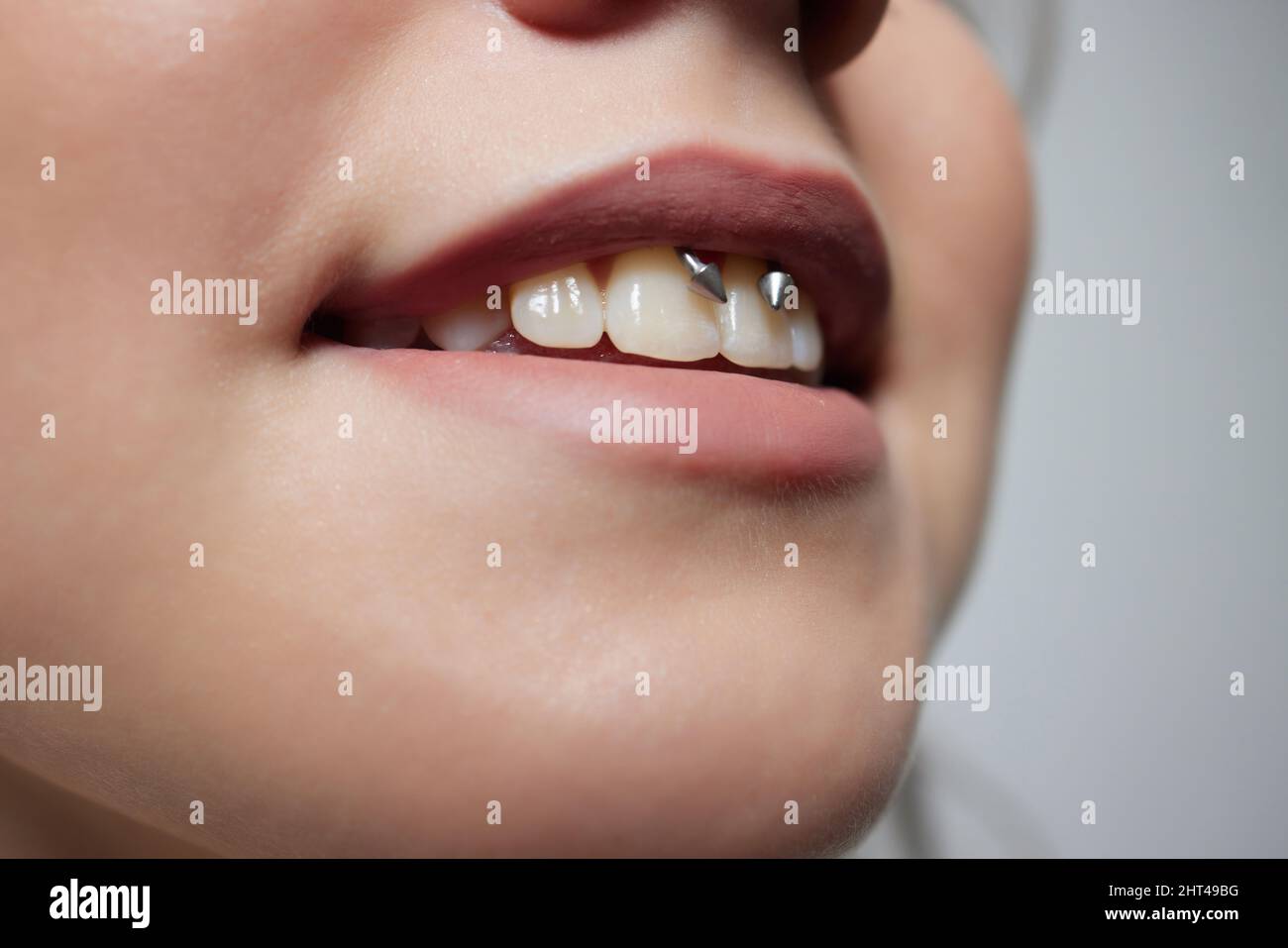 smile or frenulum piercing under the upper lip Stock Photo - Alamy