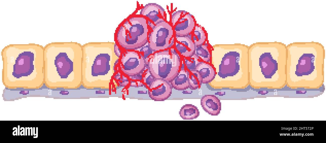 Isolated cancer cell on white background illustration Stock Vector ...