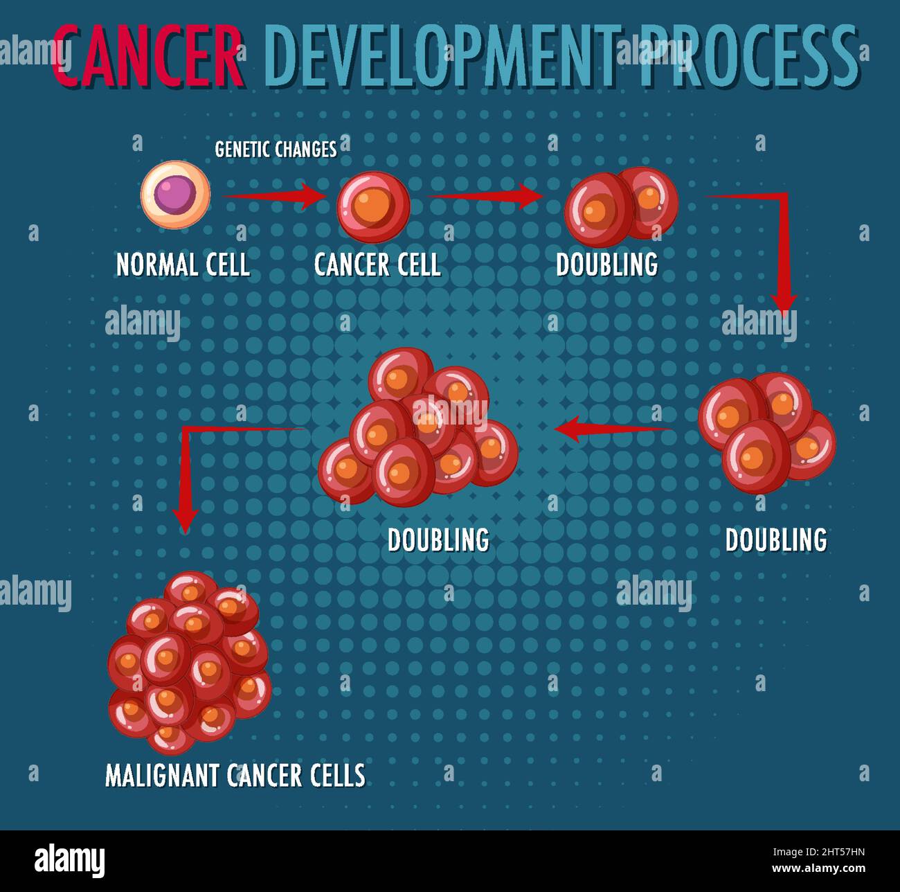 Cancer development process infographic illustration Stock Vector Image ...
