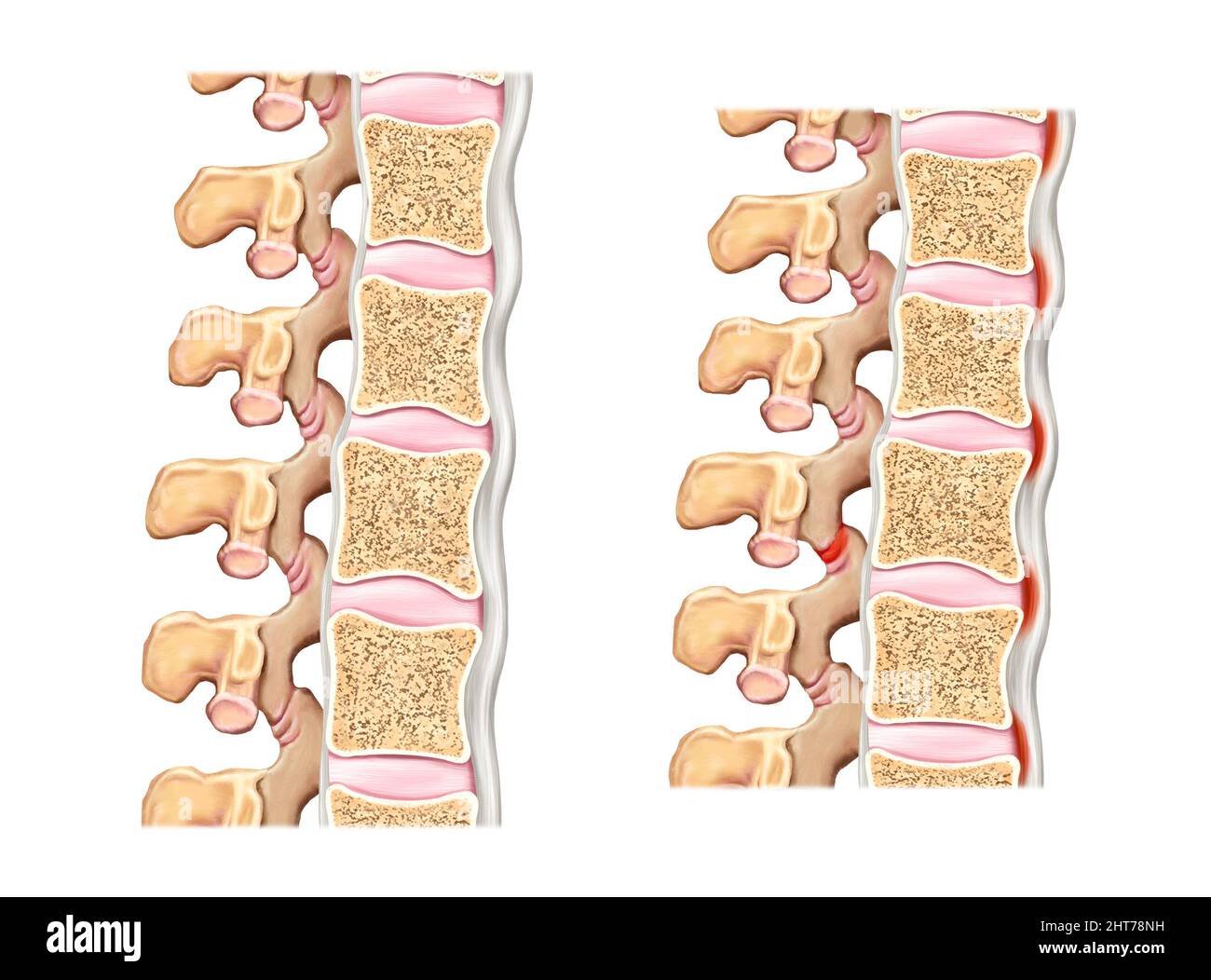 A realistic illustration of the spine and disc anatomy Stock Photo
